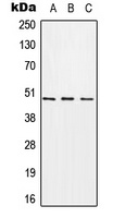 CHST1 Rabbit Polyclonal Antibody