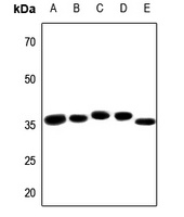 PRPF18 Rabbit Polyclonal Antibody