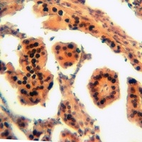 RAIDD Rabbit Polyclonal Antibody