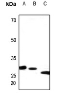 PEX11B Rabbit Polyclonal Antibody