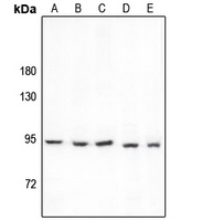 PCAF Rabbit Polyclonal Antibody