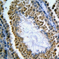 GANP Rabbit Polyclonal Antibody