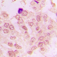 Cyclin A1/2 Rabbit Polyclonal Antibody