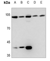Topoisomerase 3 beta1 Rabbit Polyclonal Antibody