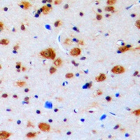 Topoisomerase 3 beta1 Rabbit Polyclonal Antibody
