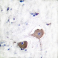 Nop30 Antibody
