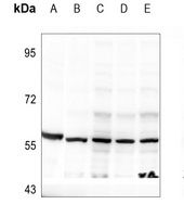 DOK2 (Phospho-Y299) Rabbit Polyclonal Antibody