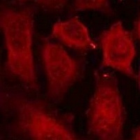 DOK2 (Phospho-Y299) Rabbit Polyclonal Antibody