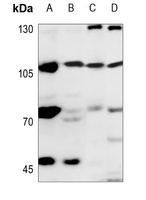 EXO1 Rabbit Polyclonal Antibody