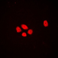 EXO1 Rabbit Polyclonal Antibody
