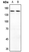 MYOM2 Rabbit Polyclonal Antibody