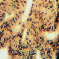 MYOM2 Rabbit Polyclonal Antibody