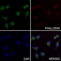 MYOM2 Rabbit Polyclonal Antibody