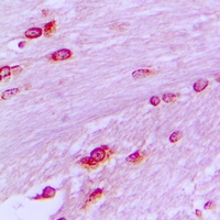 BUB3 Rabbit Polyclonal Antibody