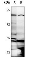MSK1 (Phospho-T581) Rabbit Polyclonal Antibody