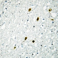 MSK1 (Phospho-T581) Rabbit Polyclonal Antibody