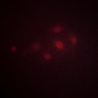 MSK1 (Phospho-T581) Rabbit Polyclonal Antibody