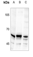 TRIP13 Rabbit Polyclonal Antibody