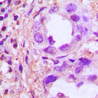 TRIP13 Rabbit Polyclonal Antibody