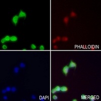 TRIP13 Rabbit Polyclonal Antibody