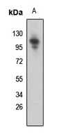 SNRP116 Rabbit Polyclonal Antibody