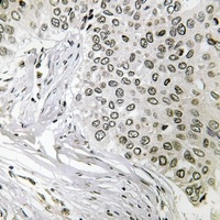 SNRP116 Rabbit Polyclonal Antibody