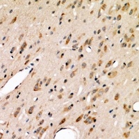 ABCG2 Antibody