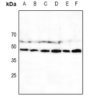 CD335 Rabbit Polyclonal Antibody