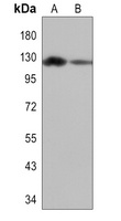 PERK Rabbit Polyclonal Antibody