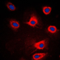 PERK Rabbit Polyclonal Antibody