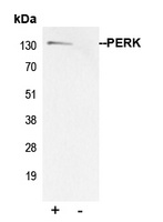 PERK Rabbit Polyclonal Antibody