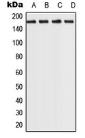 ROCK2 Rabbit Polyclonal Antibody