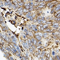 ROCK2 Rabbit Polyclonal Antibody