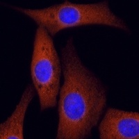ROCK2 Rabbit Polyclonal Antibody