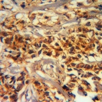 ADAMTS2 Antibody