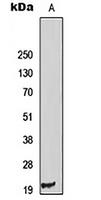 PIG11 Rabbit Polyclonal Antibody
