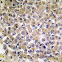 p130 Cas (Phospho-Y249) Antibody
