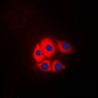 p130 Cas (Phospho-Y249) Antibody