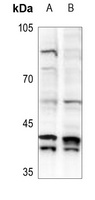 MAD2L1BP Rabbit Polyclonal Antibody