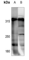 NCOR1 Rabbit Polyclonal Antibody