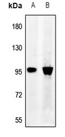 Synphilin 1 Antibody