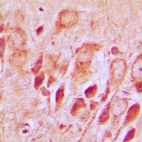 Synphilin 1 Antibody