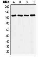Histone Deacetylase 9 Rabbit Polyclonal Antibody