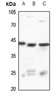 RASSF2 Rabbit Polyclonal Antibody