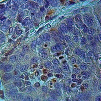 RASSF2 Rabbit Polyclonal Antibody