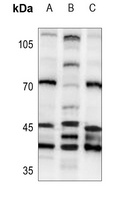 PSMD6 Rabbit Polyclonal Antibody