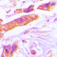 PSMD6 Rabbit Polyclonal Antibody