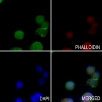 PSMD6 Rabbit Polyclonal Antibody