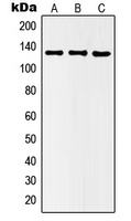 Histone Deacetylase 5 (Phospho-S498) Rabbit Polyclonal Antibody