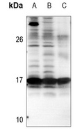 BIM Rabbit Polyclonal Antibody
